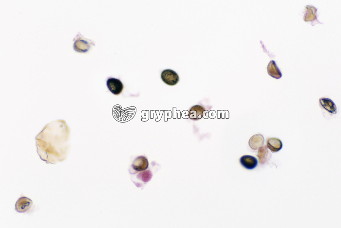 Taenia (ver parasite de l'Homme, Taenia saginata) - Oeufs dans déjections x40 - gryphea.com